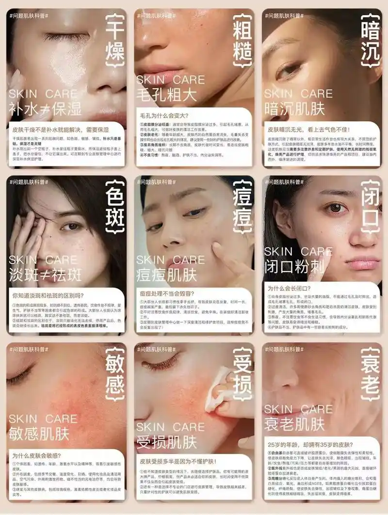 九大肌肤问题形成原因98新手姐妹必看73.