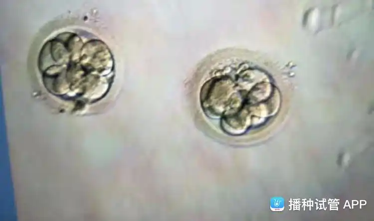 [试管婴儿]第三天的胚胎(如图).请问可以