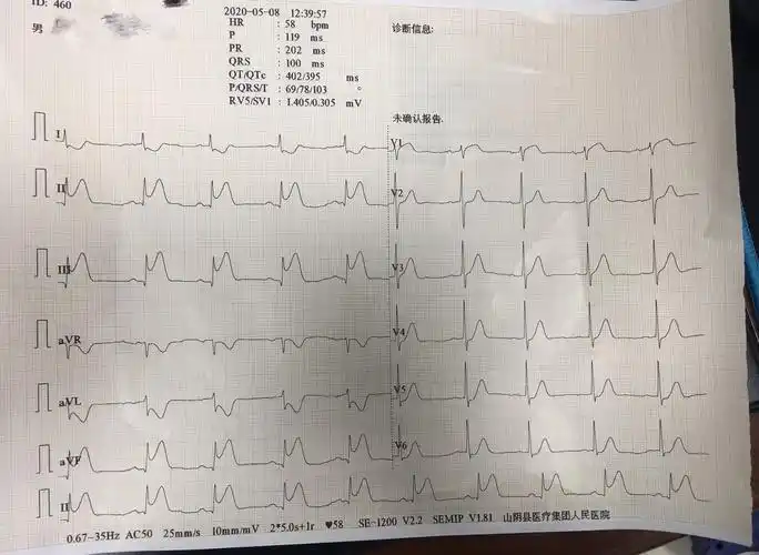 山阴县医疗集团胸痛中心无缝衔接成功救治62岁急性心梗老人