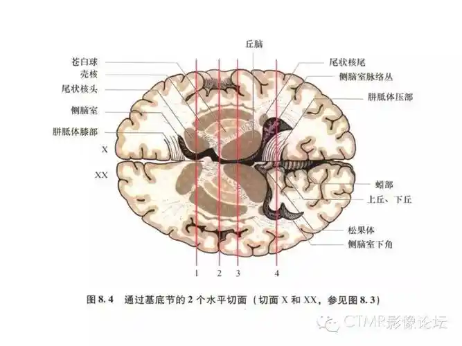 基底节区解剖学关系图解