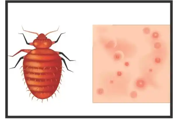 缝隙_床板_周边