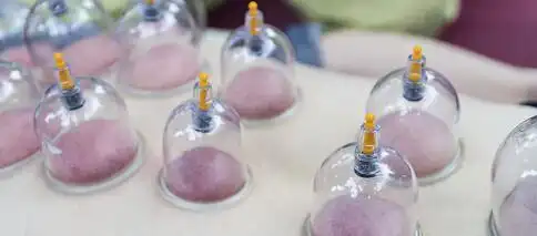 1,皮肤受损拔罐分为拔气罐和拔火罐,一般来说拔火罐更容易出现物乌紫