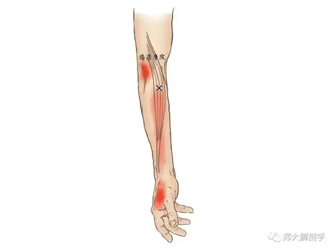 网球肘治疗点(之二) - 好大夫在线