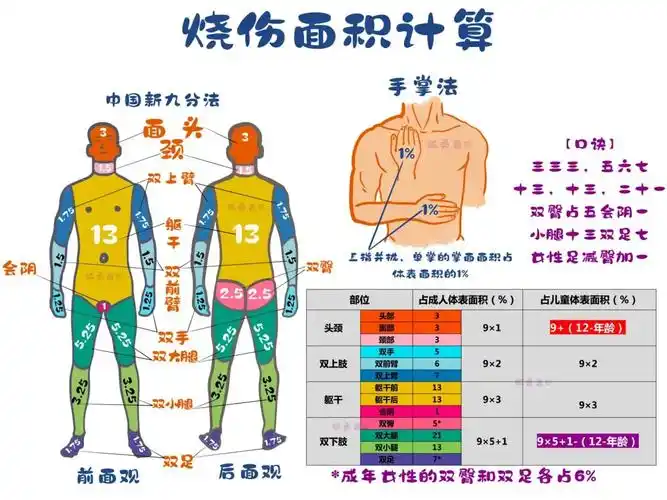烧伤面积的估算
