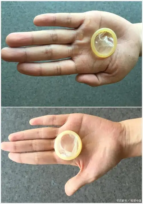 男童酒店客房误食用过的安全套