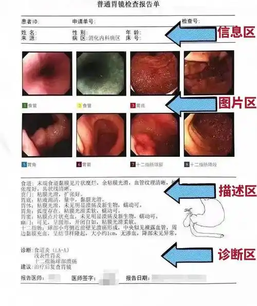胃镜报告不会看手把手教你怎么看胃镜报告