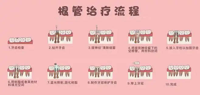 根管治疗口腔牙齿医疗治疗过程刘玉美68design