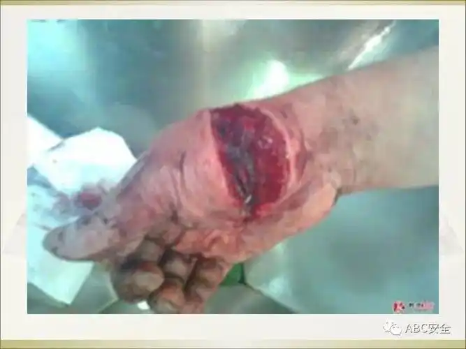 血腥慎入生产安全事故案例培训教材ppt