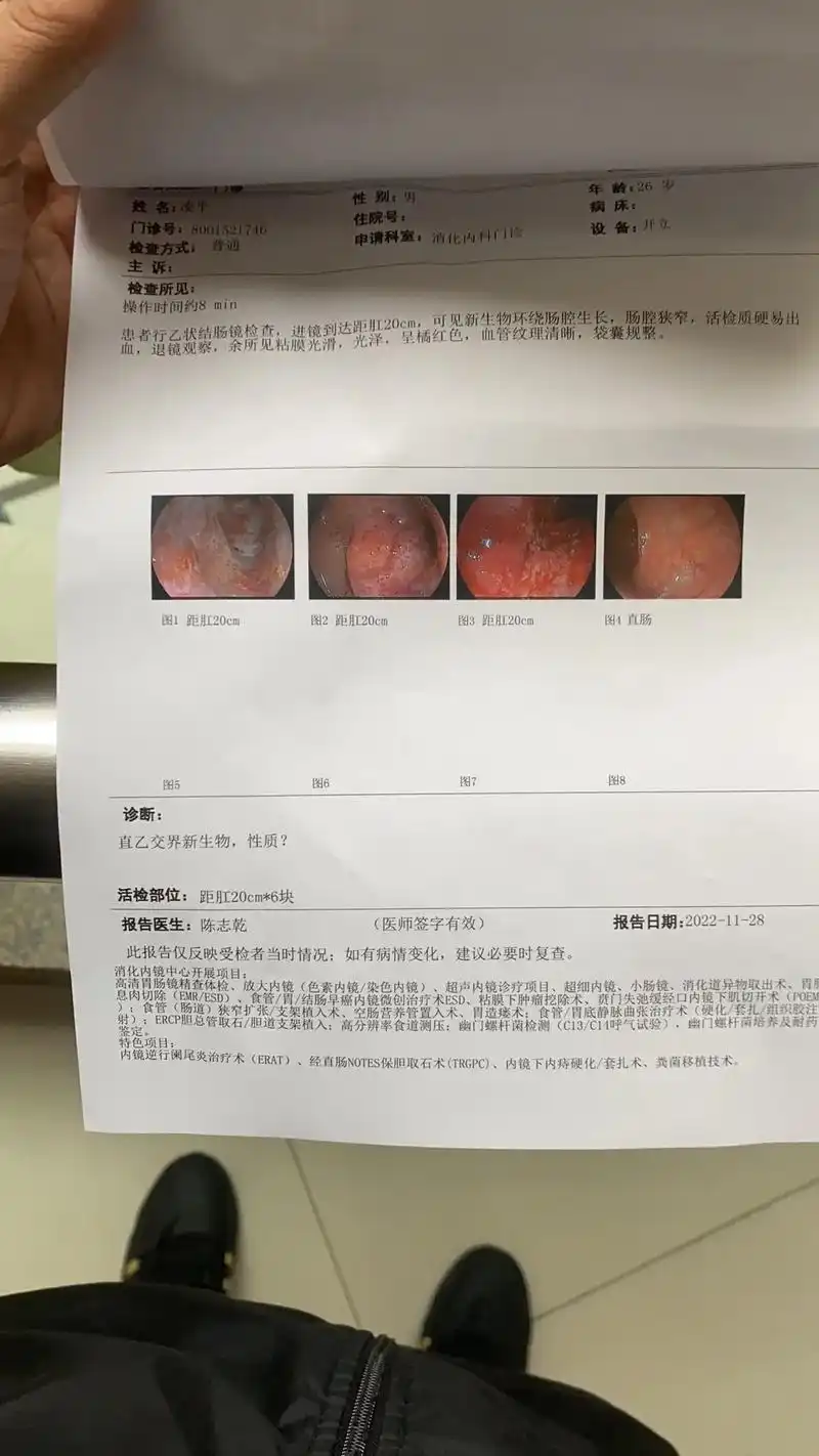 人生无常呀!#结肠癌晚期 #印戒细胞癌 自己种的因自己吃这个 - 抖音