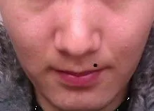 男人这个位置有痣,代表什么?