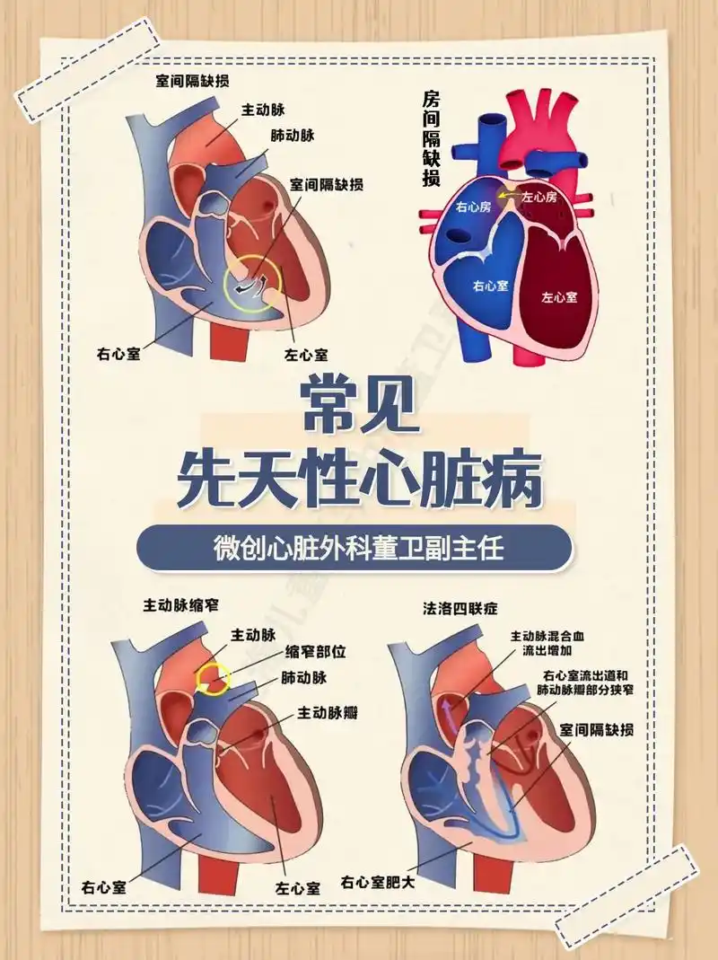 常见先天性心脏病.常见#先天性心脏病有房间隔缺损,室间隔缺损 - 抖音
