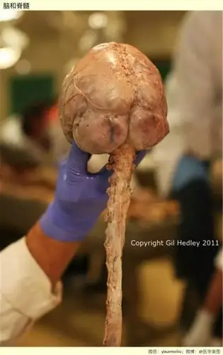 这些神经解剖图医科书上也不会这么逼真