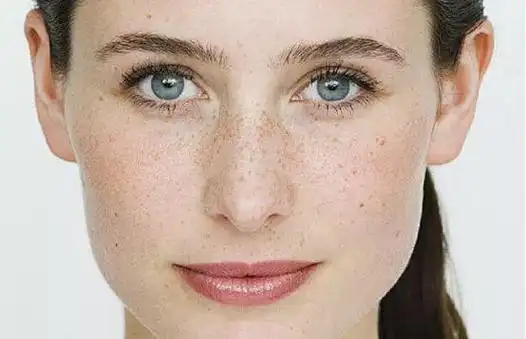 不管有没有长斑,只要有这些坏习惯,趁早改|色斑|皱纹|色素|皮肤细胞