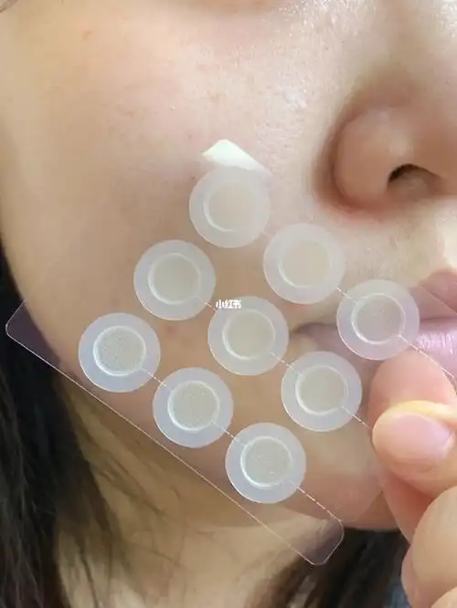 微针痘痘贴果然比普通痘痘贴好用_痘痘贴_微针_祛痘_长痘痘_好物推荐