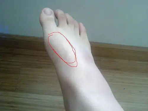 脚背一踢球会痛,就图片的位置,走路跑步什么都没问题,只要我正脚背