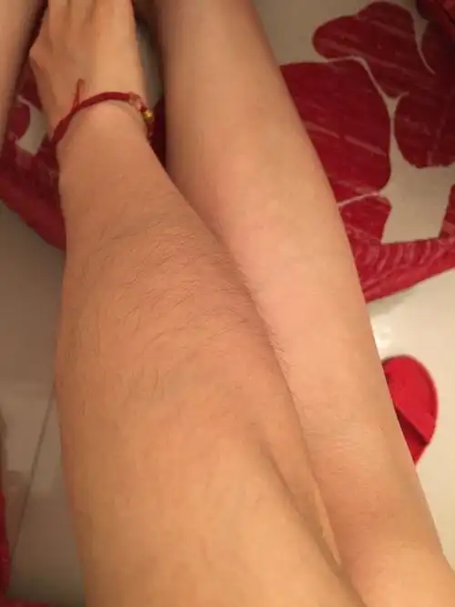 女孩们夏天到了你们脱毛好了吗