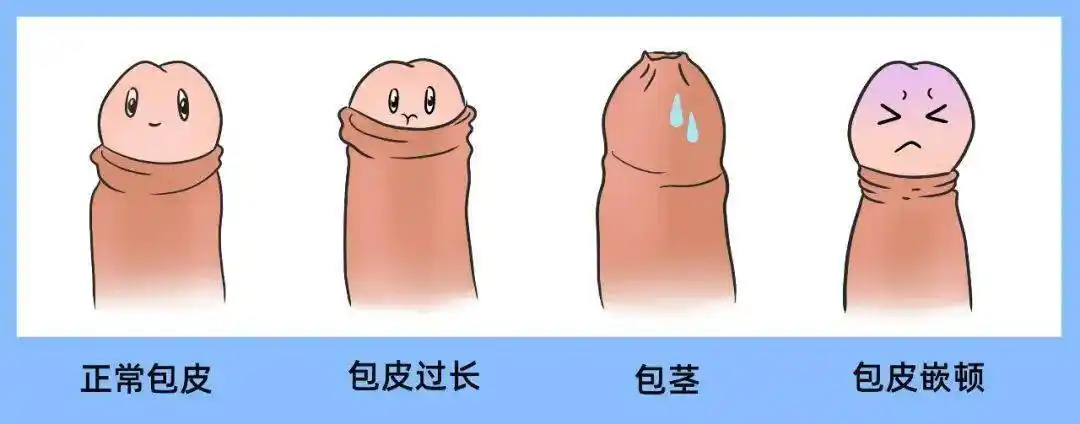 很多男同胞发现「丁丁」