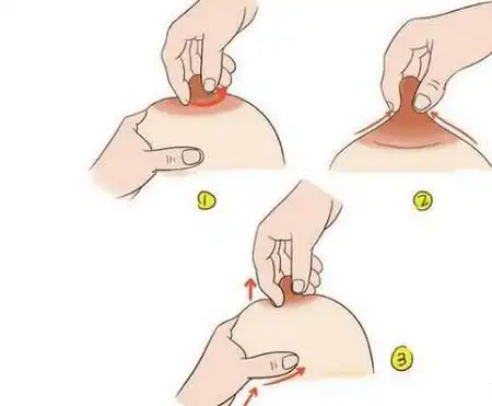 (2)催乳按摩法:乳头催乳按摩法,妈妈一只手托住乳房,另一只手的闹指