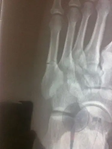  我来答      微信扫一扫 网络繁忙 请稍后重试 新浪微博 qq空间