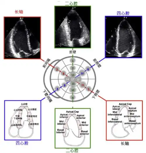今日份干货请查收 → 超声如何诊断冠心病在 17 节段划分法中, 17 个