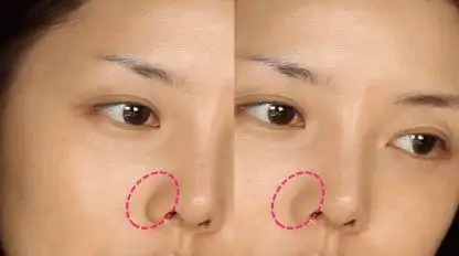 五官:佟丽娅一直在苦笑?不,苦相和凄美是有区别的