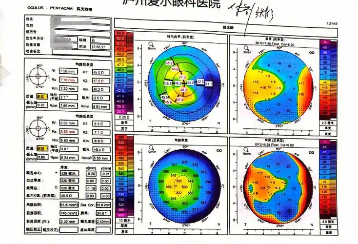 帮忙看看眼角膜地形图,这样的地形图是不是确证圆锥形角膜了呢?