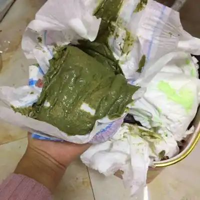 我家宝宝三个半月了放屁很臭而且还拉绿便便,宝妈们