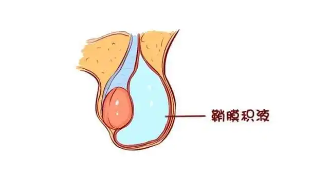 一般而言,宝宝的睾丸不会完全停留在腹中,而是位于腹股沟和阴囊附近