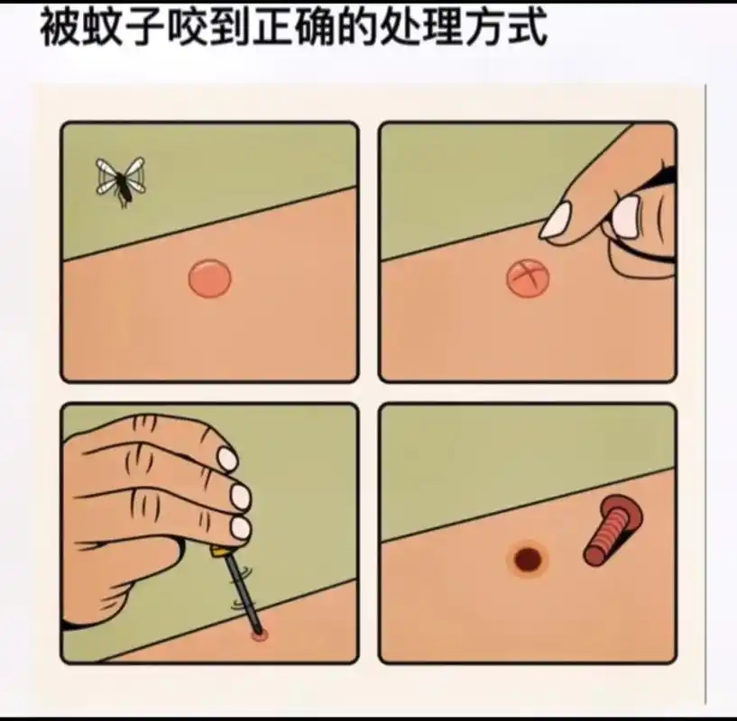 昨天跟蚊子战了一宿,最后打成了平手,它没吃饱,我没睡好#蚊子 - 抖音