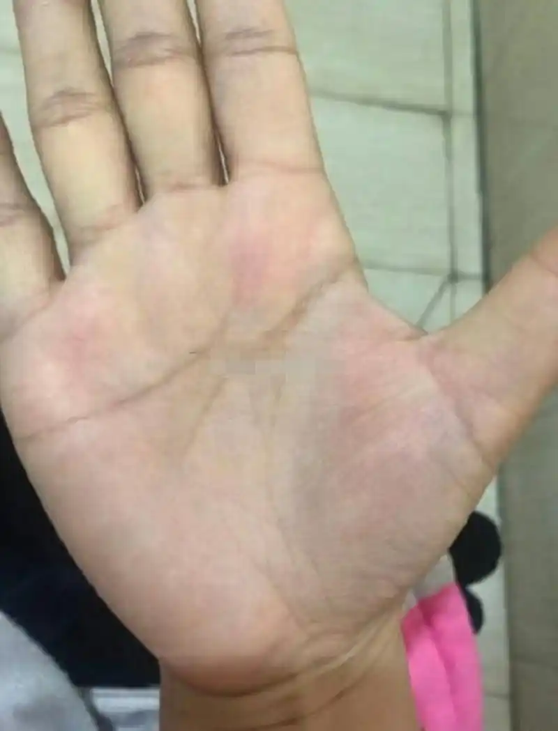 缘主的手掌方正属于金型手,也称实干手,有这种手形的人,个性比较实际