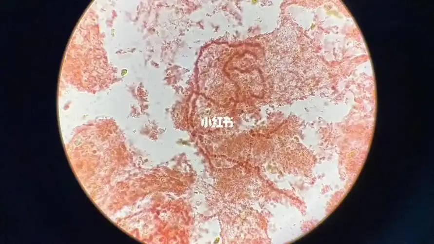 果蝇唾液腺染色体制片