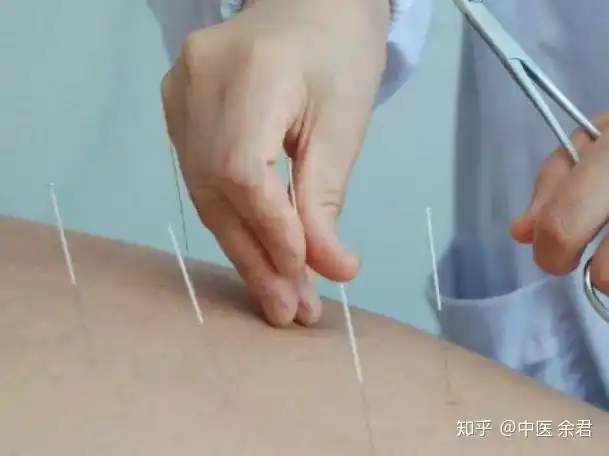 痛经?中医治疗有妙招