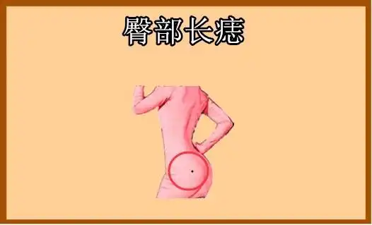 千金难买5颗痣一个升官一个增财颗颗显贵皇帝命