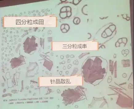 中药知识必学:半夏之鉴定