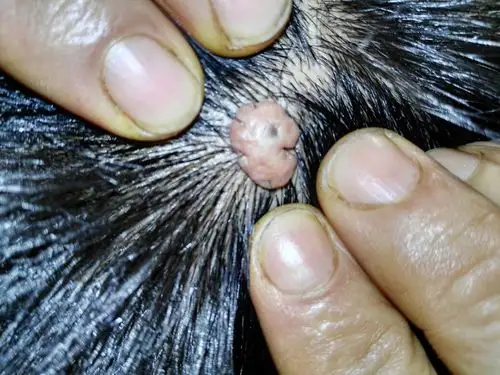 这个肉疙瘩是老爸头上长出来的,差不多有十几年了.不疼不痒的.