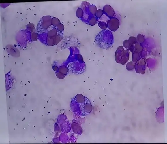 巨噬细胞吞噬功能实验,小鼠巨噬细胞吞噬鸡红细胞.
