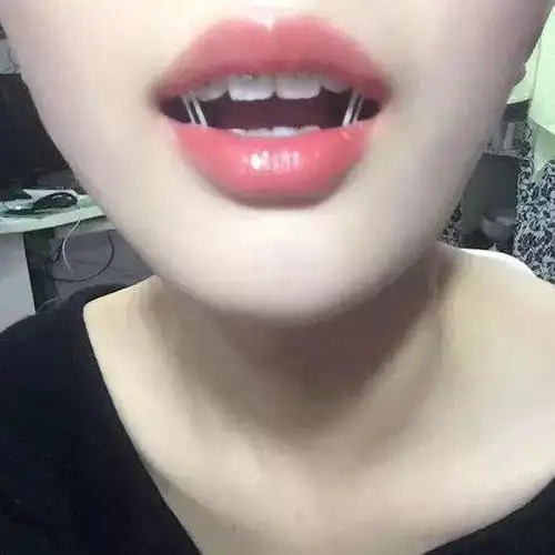 不管你看不看延禧攻略都应该了解一下拔丝尔晴其实这是一篇口腔科普