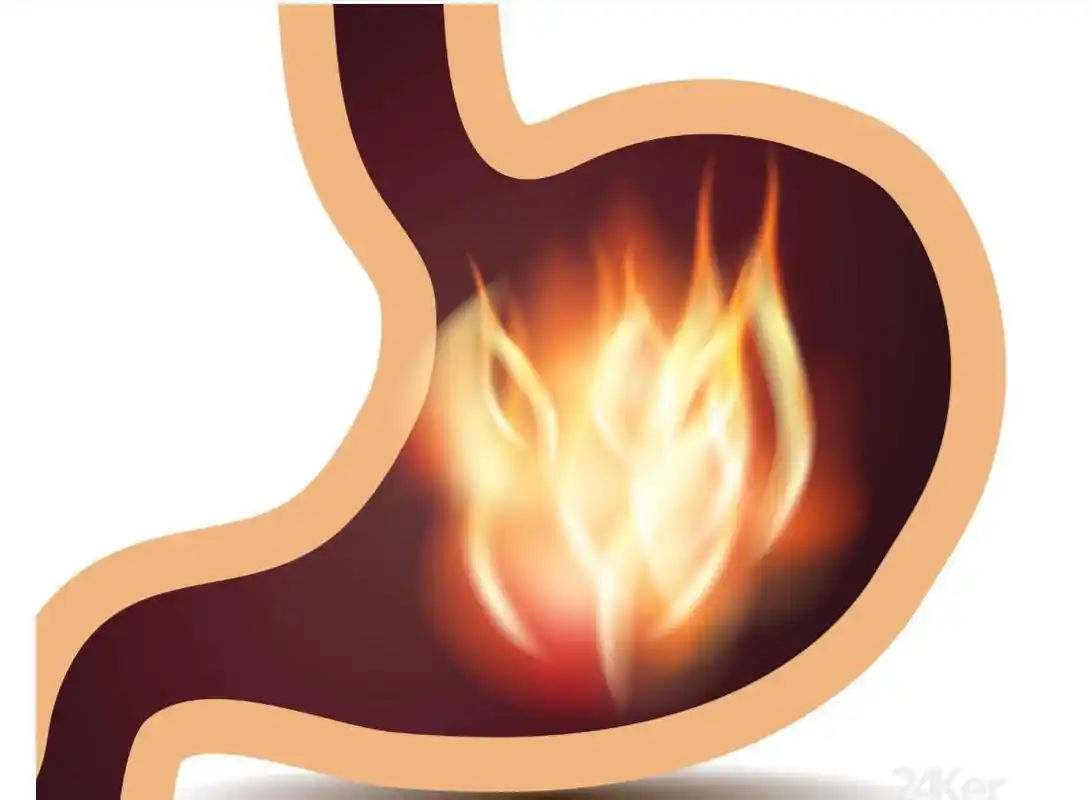 一招教你治愈胃酸过多烧心