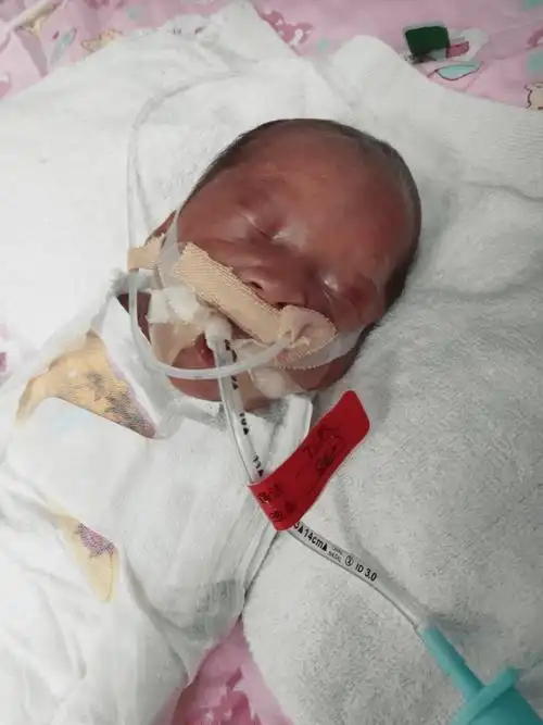 怀孕六个月男胎儿图片(怀孕六个月胎儿图片男)