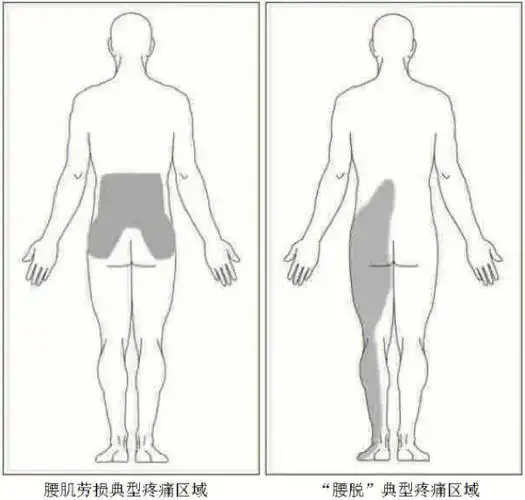 腰椎感染腰背肌筋膜炎,腰椎结核还有一些内脏疾病或妇科疾病等人们