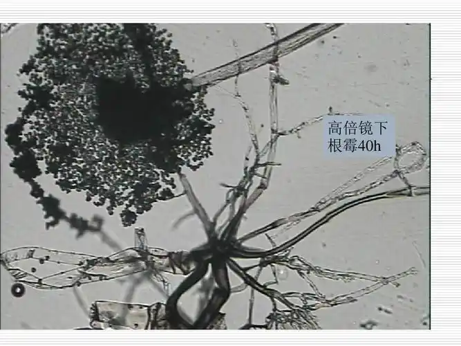 实验四,霉菌的形态观察ppt