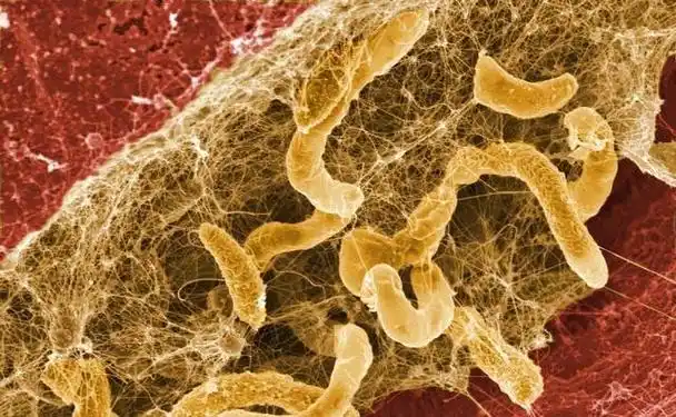 揭秘国际空间站细菌困扰:难以清除的真相