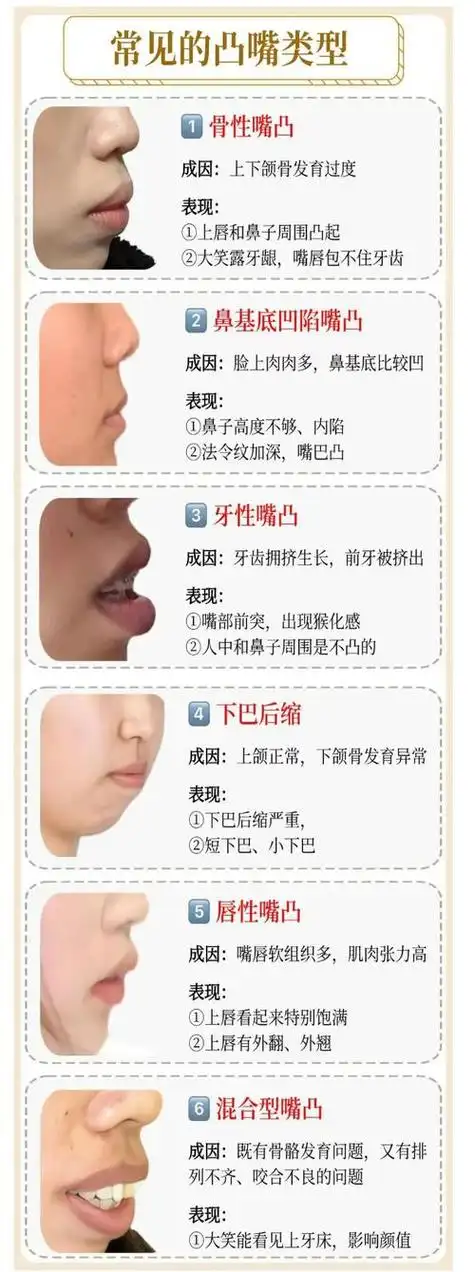 嘴巴瘪能整容吗女人面相 嘴巴太瘪人的面相