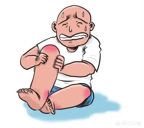 剧烈运动会使痛风发作吗