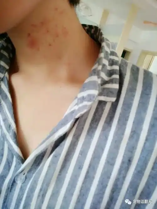 内涵猫咪在女主人脖子上种草莓和踩奶网友谁吸的不好说