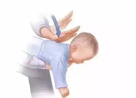 3,婴儿版5次拍背法将患者的身体扶于救护员的前臂上,头部朝下,救护员