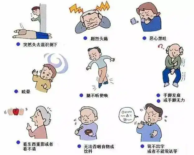 预防中风需要做7个检查|超声波|颈动脉|动脉瘤|脑血管|脑电图|中风