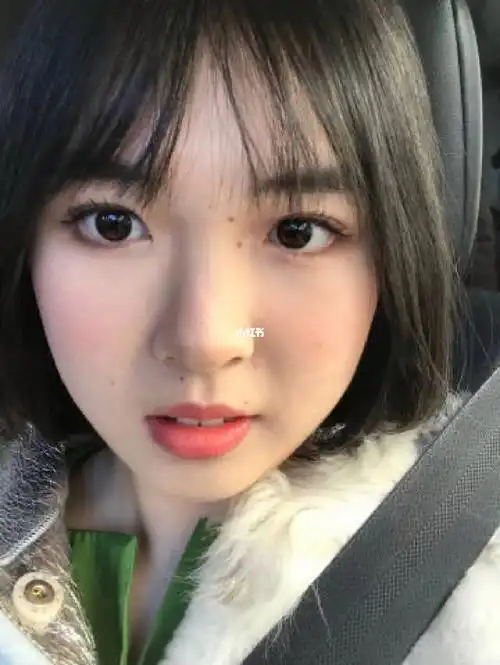 我的兔子牙终于有救了!宁波戴牙套