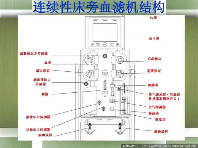 连续性床旁血滤机ppt