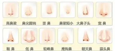 如何避免注射隆鼻导致鼻梁变宽!